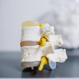 white and yellow cake on white table